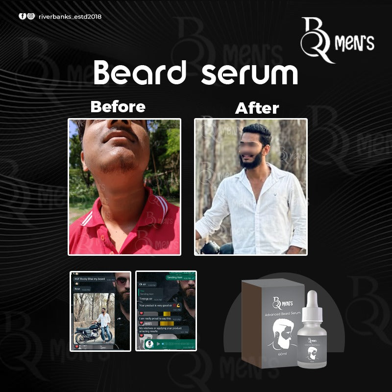 RB MEN`S BEARD GROWTH SERUM (60ml)