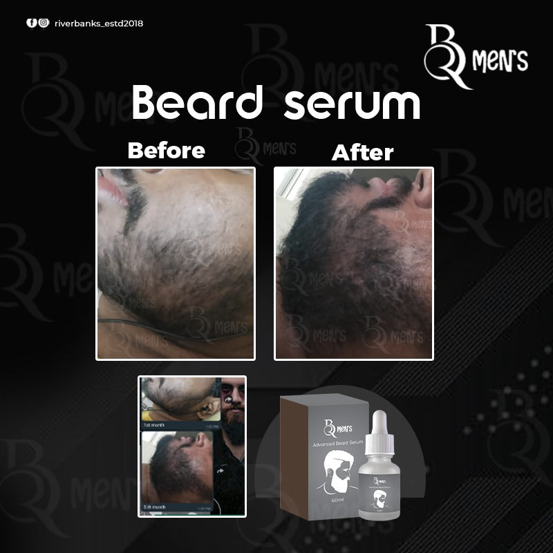 RB MEN`S BEARD GROWTH SERUM (60ml)