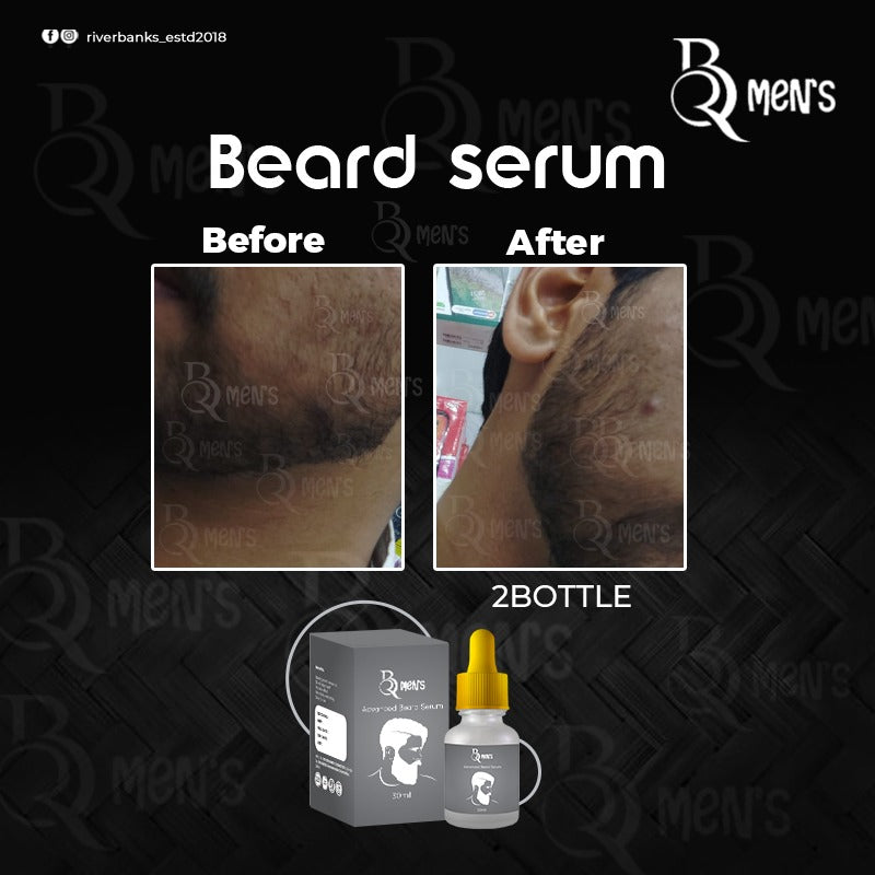 RB MEN`S BEARD GROWTH SERUM -2PS COMBO (35ml)