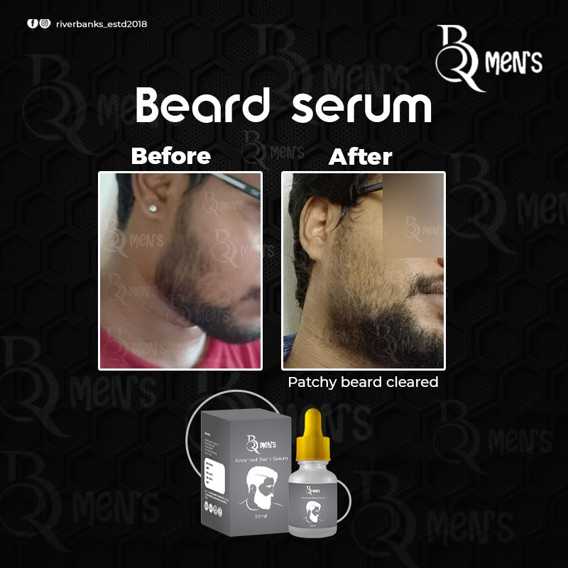 RB MEN`S BEARD GROWTH SERUM -2PS COMBO (35ml)