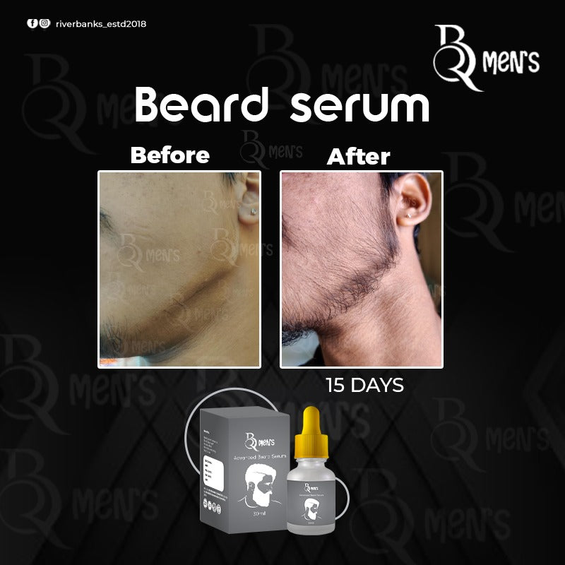 RB MEN`S BEARD GROWTH SERUM -2PS COMBO (35ml)