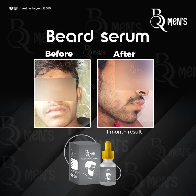 RB MEN`S BEARD GROWTH SERUM (60ml)