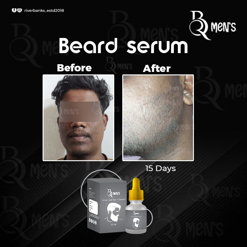 RB MEN`S BEARD GROWTH SERUM -2PS COMBO (35ml)