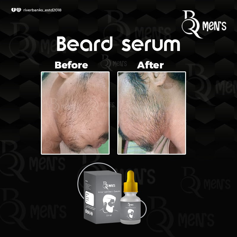 RB MEN`S BEARD GROWTH SERUM -2PS COMBO (60ml)