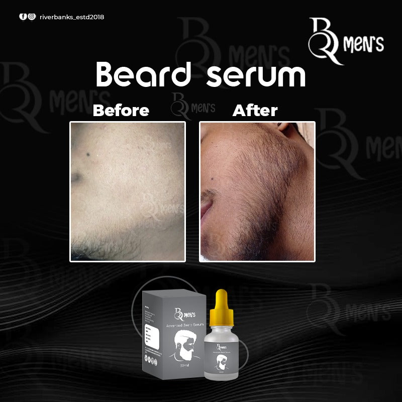 RB MEN`S BEARD GROWTH SERUM (60ml)