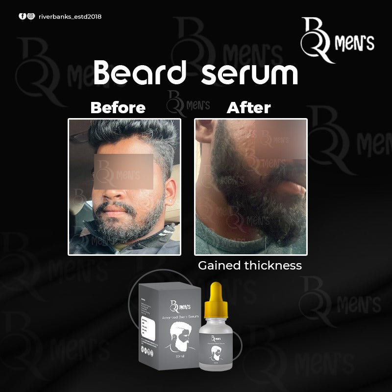 RB MEN`S BEARD GROWTH SERUM -2PS COMBO (35ml)