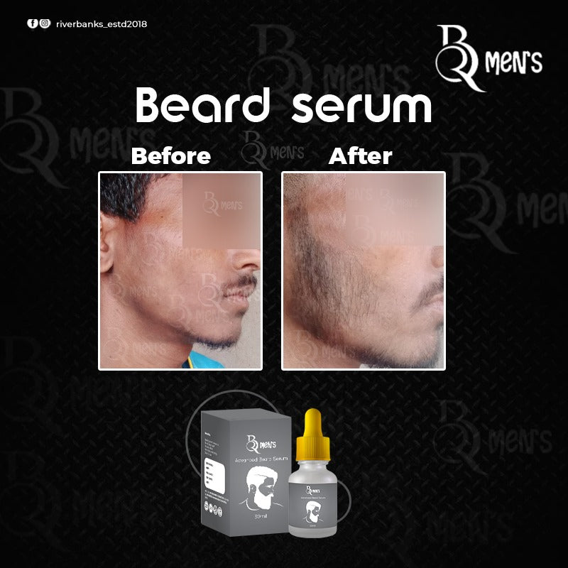 RB MEN`S BEARD GROWTH SERUM -2PS COMBO (35ml)