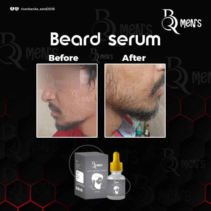 RB MEN`S BEARD GROWTH SERUM -2PS COMBO (60ml)