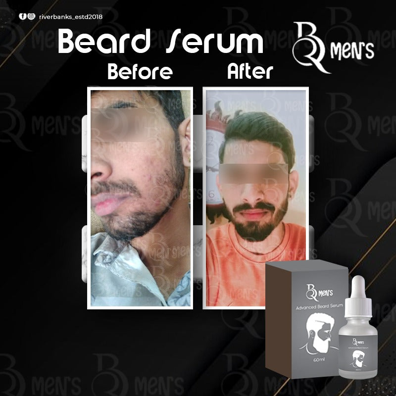 RB MEN`S BEARD GROWTH SERUM (60ml)